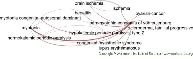 Eulenburg’s disease